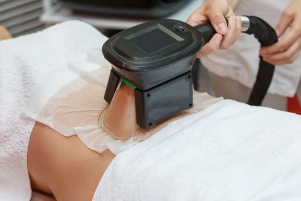 Image of person having fat freezing treatment to help weight gain Sussex