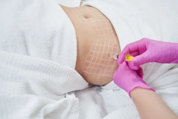 image of fat dissolving injections on love handles to help combat weight gain Sussex