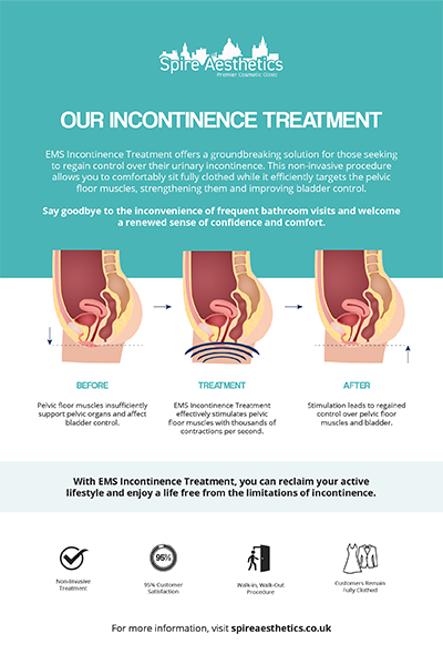 image of how urge incontinence Sussex treatment works