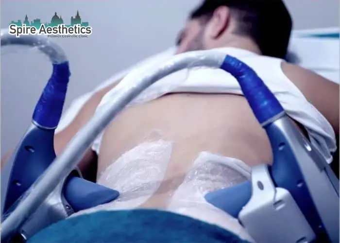 Man having fat freezing treatment done on love handles before a competitions Sussex to create a sculpted look.