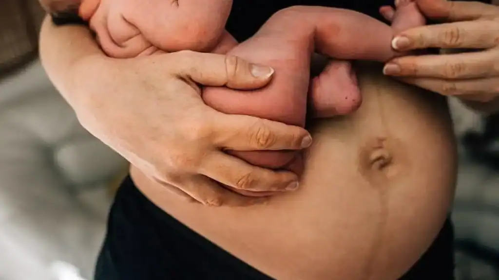 Why Is My Stomach Still Big After Pregnancy Sussex?